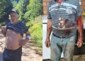 Agricultor relata ter sido atacado por puma no interior do RS: ‘vi que era um bicho grande’