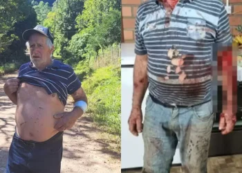 Agricultor relata ter sido atacado por puma no interior do RS: ‘vi que era um bicho grande’