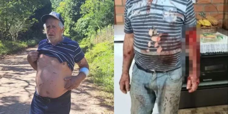 Agricultor relata ter sido atacado por puma no interior do RS: ‘vi que era um bicho grande’