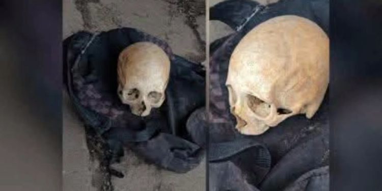 Crânio encontrado em parada de ônibus em São Leopoldo pode ter sido furtado de cemitério